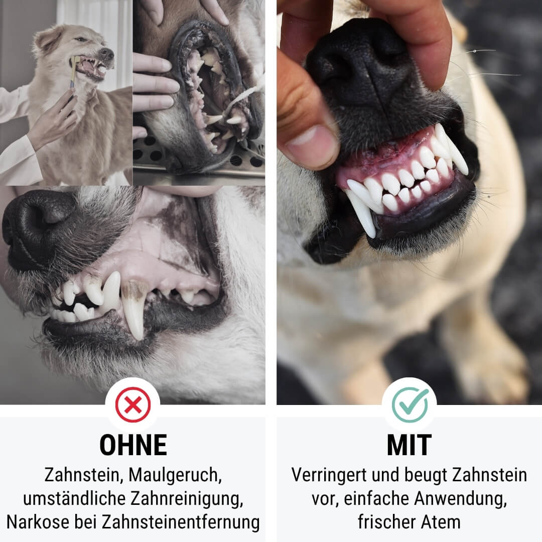 Bon AppéTeeth